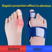 Corrector De Torneos Grande Protección De Pies Alivio Del Dolor Articulación Valgus Herramienta De Cuidado De Los Pies - details 3