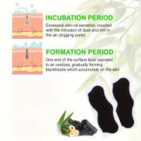Máscara De Carbón De Bambú Para Eliminar Puntos Negros Y Acné Tratamiento Profundo Para La Piel Del Rostro Y Nariz Adhesivo De Puntos Negros - details 3