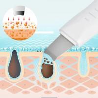 Limpiador Facial Vibratorio Profundo Skin Scrubber No Ultrasonido Espátula Exfoliante Eliminador De Quimiotacto Masajeador Facial - details 2