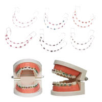 1 Par De Decoraciones Colores Para Dientes Con Alambre De Metal Y Ligaduras Ortodónticas Adornos Dentales Temporales Para La Piel - details 0