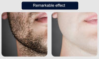 Afeitadora Eléctrica Portátil Para Hombres Mini Cannon De Acero Aleman Cabeza Redonda Potente Storm Shaver Importado De Alemania - details 5