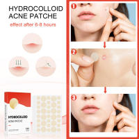 Set De 144 Parches De Acné Profesionales Para Cuidado De La Piel Alta Gama Absorciónde Espots Y Curación Covering Acne Herramientas De Cuidado Facial - details 7