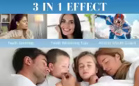 Protectores bucales para apretar los dientes por la noche, protector bucal para rechinar los dientes, protector bucal reutilizable para dormir por la noche, protector nocturno para los dientes (juego de 4 piezas) - details 3