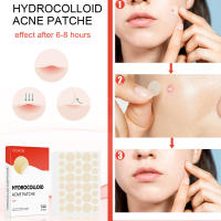 Parches Para Acné Y Marcas De Puntos De Cuidado Facial 144pcs Invisibles Tratamiento De Acné Y Cicatrices De Puntos Para Belleza - details 2
