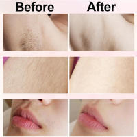 Afeitadora Eléctrica Para Mujer Painless Epilador Facial Cabello De Barba Bikini Axila Pierna Impermeable Afeitadora Eléctrica - details 6