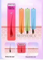 Epilador Láser 4-en-1 IPL Photoepilador Painless Máquina De Eliminación De Vello Permanente Para Cuerpo Y Rostro Epilador Eléctrico Para Mujeres - details 15