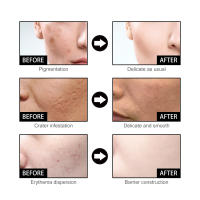 La esencia facial de niacina EELHOE atenúa las marcas del acné, hidrata, reduce los poros, blanquea la piel y embellece la piel. - details 9