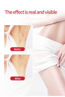 Epilador Eléctrico Para Mujer Recargable Herramienta De Eliminación De Vello Mini Afeitadora Trimmer De Cejas Y Cara - details 4