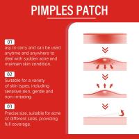 240Pcs Parches De Acné De Alta Gama Forma Corazón/Estrella Para Cubrir Espinillas Y Manchas Hidratantes Pack De Cuidado Facial - details 2