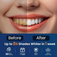 Tiras blanqueadoras dientes blanqueador dental - blanqueadores dentales teeth 28 Piezas whitening strips dientes 14 Tratamientos blanqueamiento dental blancos Seguro para Esmalte Refresca Respiración - details 0
