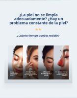 Aparato Limpieza Facial Profesional-Eliminar Puntos Negros Device with 6 Boquillas - Tecnología de Succión y Oxigenación - 3 NIVeles de Potencia Ajustable - Recargable USB - details 1
