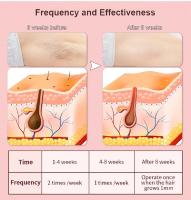 Bicuadrícula De Láser IPL Para Eliminación De Vello Corporal Y Bikini Mano Portátil Piel Suave Y Sin Dolor 999999 Chisporreos Uso Doméstico Para Mujeres - details 7