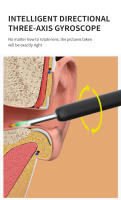 NE3-A Limpieza visual de cerumen con Cámara Otusope Iluminado - details 7