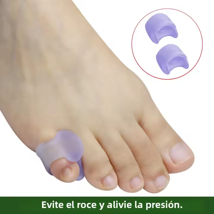 Pexmen 2Pcs Separadores De Dedos De Gel Para Hombres Y Mujeres Almohadillas De Bunión Para Prevenir Raspaduras Y Aliviar La Presión Color Rosa - 1