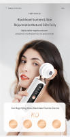 Quita Puntos Negros Eléctrico Recargable Por USB Herramienta De Eliminación De Imperfecciones Para Rostro De Hombres Y Mujeres - details 3