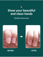 Herramienta De Manicura De Alta Calidad Para Eliminar Cutículas Y Quitar Piel Muerta Pusher De Acero Inoxidable Grado Cirúrgico Limpiador Y Afilador De Uñas - details 3