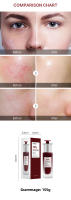 Ácido Frutal Extracto de Ácido Salicílico Esencia Hhydratante Exfoliante Puntos Negros Marcas de Acné Reducción de Poros - details 1