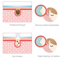 Máquina De Cuidado De La Piel Digital Para Eliminar Acné Y Quemaduras De Puntos Negros Con Microdermabrasión Y Vacío Herramienta Profunda Limpieza De Poros - details 9