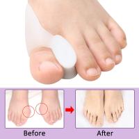 Protector De Gel Para Dedos Mayores Corrector De Bunion Alivio Del Dolor Hallux Valgus Ortopédico Separador De Dedos Paquete De 2/4/8 - details 1