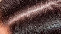 Opal Beauty - Masajeador Capilar de Bambú con Cerdas de Silicona Suaves - Ideal para Estimular el Cuero Cabelludo, Relajar, Mejorar la Circulación Sanguínea, Reducir el Estrés, Promover el Crecimiento del Cabello, Limpieza Profunda y Masajes Antiestrés - details 2