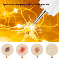 Pluma para detectar lunares, equipo de eliminación de manchas, instrumento de belleza láser, salón de belleza Facial, pluma para detectar lunares, oro rosa - details 2