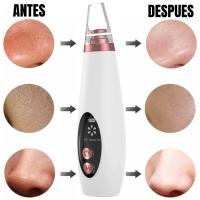 Succionador de Poros y Puntos Negros Espinilla Quita Granos Equipo o Aparato Aspirador Impurezas Facial Recargable 6 cabezales Intercambiables 3 modos de potencia Limpiador de Sebo Grasa Extractor Limpieza a Fondo - details 1