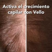 Ybera Paris Sérum Vital Vello Tratamiento Capilar - Estimula el Crecimiento Acelerado del Cabello - Reduce la caída - details 0