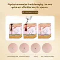 Pluma Detectar Lunares Belleza Láser Salón Facial Rose Gold - details 5