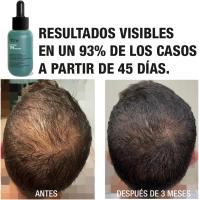 Tahe Concentrado anticaída densificante con multipéptidos Peptide T98 50 Ml. / Frena la caída y activa el crecimiento desde la raíz. - details 5