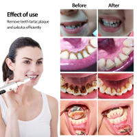 Limpia Dientes Ultrasonido Eliminador De Calcafores Y Placa Eléctrico Herramienta Para Limpieza Oral Eliminador De Manchas Y Piedras Dentales - details 4