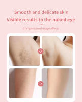 Afeitadora Eléctrica Para Mujer 2 En 1 Trimmer De Aliento Y Eliminador De Vello Facial Cuchilla Epilador Painless Para Bikini Y Pubis - details 10
