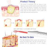 Bastón De Belleza Facial Portátil 4-en-1 Con Alta Frecuencia Herramienta Eléctrica Para El Cuidado De La Piel Tratamiento De Acné Máquina Neon - details 3