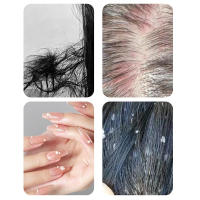 Cepillo De Baño Con Mango Largo Para Masaje Del Escalpelo Y Exfoliación De Cuerpo Herramientas De Peinado Para El Cabello Presiona Para Dispensar - details 6