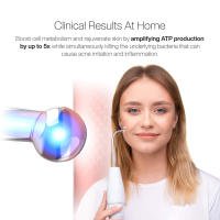Máquina de Belleza Facial de Alta Frecuencia Vara de Electroterapia para Cuidado de la Piel de Spa - details 2