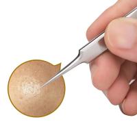 Aguja De Acné Ultrafina Alemana Número 5 Herramienta Especial Para Eliminar Quistes Y Caspa De La Cara Para Belleza Y Salud En Salones - details 2