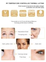 Dispositivo De Masaje Facial RF De Alta Frecuencia Máquina De Levantamiento Facial Eliminador De Arrugas Matriz Dot Skin Tightening Rejuvenecimiento De La Piel Batería Recargable Plástico - details 2