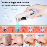 Limpiador De Puntos Negros USB Recargable Suction Vacío Facial Extractor De Comedones Quimono Negro Para Limpieza De Rostro - details 4