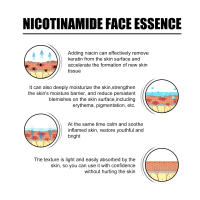 La esencia facial de niacina EELHOE atenúa las marcas del acné, hidrata, reduce los poros, blanquea la piel y embellece la piel. - details 7
