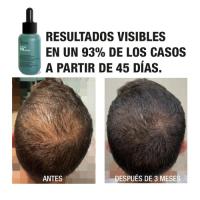 Tahe Pack Concentrado 200 ml + Champú 300 ml Peptide T98 | Pack que incluye los productos Concentrate Peptide T98, un tratamiento anticaída densificante, y Shampoo Peptide T98, champú anticaída densificante. - details 6