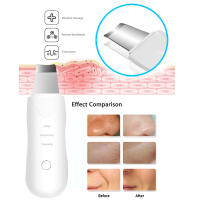 Máquina De Limpieza Profunda Facial Portátil Eléctrica Ultrasonda MIKO NICE ST-457 Con Cargador USB Herramienta De Exfoliación De Piel - details 5