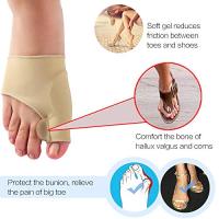 2 UDS. Calcetines ortopédicos para corrección de juanetes y Husos grandes, corrector de hallux valgus de silicona - details 3