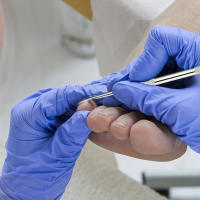 Kit Profesional De Uñas Con Acrisio Y Lijador De Acero Inoxidable Herramientas De Pedicura Seguras Para Aliviar El Dolor Incluye Archeador Y Levantador - details 3
