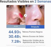 medicube Zero Pore Pad 2.0 | Almohadillas Exfoliantes con AHA, BHA y Centella Asiatica | Reduce Puntos Negros 44,9%, Sebo 30,5% y Poros | Doble Textura | Todo Tipo de Piel | Cosmética Coreana | 70 uds - details 2