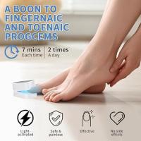Dispositivo de lámpara de limpieza de hongos de uñas, solución de uso eficaz para uñas gruesas y decoloradas dañadas, para uso doméstico, eliminador de hongos de uñas recargable - details 5