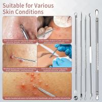 Set De 8 Piezas De Agujas Para Acné Y Remoción De Quistes Set De Herramientas Precisas Para Eliminar Quistes Y Blackheads Para Hombres Y Mujeres - details 2