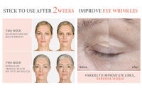 Masajeador Facial Eléctrico 4 En 1 Con Calentamiento Y Vibración Herramientas De Scraping Facial Antiarrugas Levantamiento De Pecho Doble Dispositivo De Cuidado De La Piel - details 5