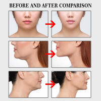 100pcs Cinta De Levantamiento Facial Invisible En V Para Ojos Y Barba Antiarrugas Levantamiento De Mentón Cuidado De La Piel Resistente Al Agua - details 8