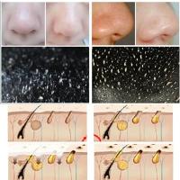 Mascarillas De Tratamiento Contra Acné Y Blackheads Profundo Limpieza Reducción De Poros 10PCS MDUG Sin Fuente Eléctrica Originales De China Continental - details 4