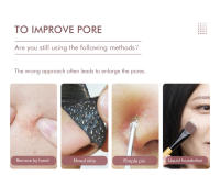 Instrumento de limpieza facial vibratorio, cuidado de la piel, eliminador de puntos negros y acné, herramienta de limpieza de poros faciales, instrumento de limpieza de poros para eliminación de aceite de puntos negros faciales - details 2