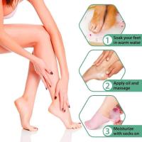 Calcetines De Cuidado De Pies Con Gel De Silicona Para Hidratación Y Alivio Del Dolor Protección Contra Piel Muerta Y Agrietada Herramientas De Pedicura Para Mujeres - details 2